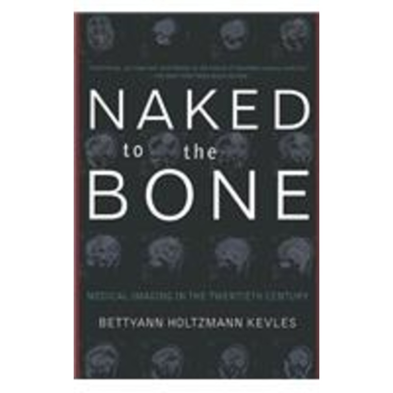 naked to the bone: medical imaging in the twentieth century